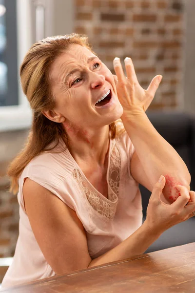 Зрелая женщина чешет локоть из-за аллергической сыпи — стоковое фото