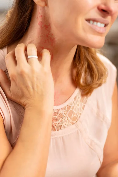 Blond woman feeling awful having rash and reddening on neck — Stock Photo, Image