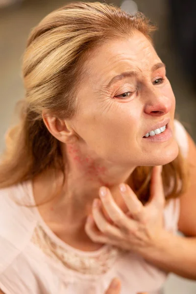 Aged woman scratching her neck while having rash and fever — Stock Photo, Image