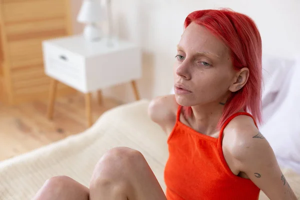 Mujer joven con bulimia sintiéndose mareada y miserable — Foto de Stock
