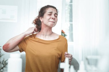 Alerjisi nedeniyle boynunda ve kollarında döküntü olan kadın