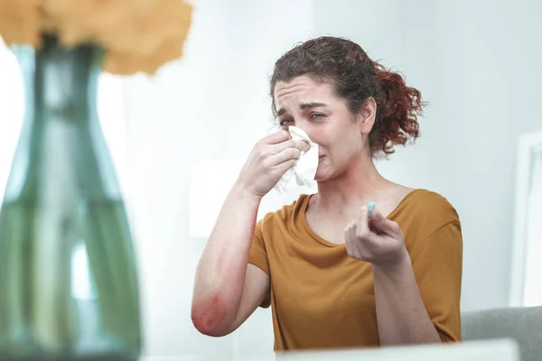 Жінка в помаранчевій сорочці сушить ніс, що страждає від алергії — стокове фото