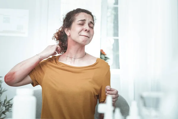 У женщины сыпь на шее и руках из-за аллергии — стоковое фото