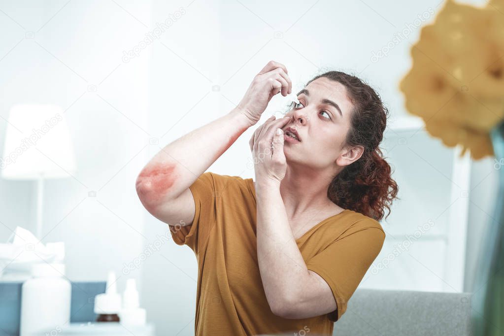Curly woman with scratches on elbow dropping her eyes