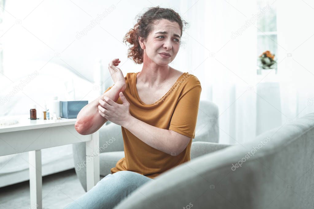 Curly mature woman having reddening after allergy to chemicals