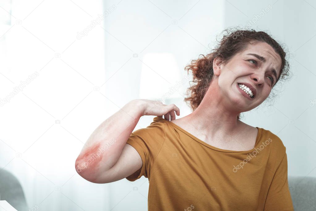 Woman scratching her body while having allergy to chemicals