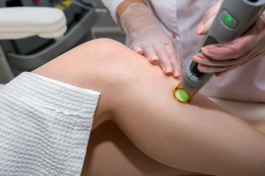 Kozmetik güzellik merkezindeki bir terapistten saç çıkarma kozmetik prosedürü. Lazer epilasyon ve kozmetoloji.