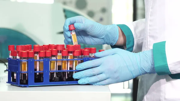 Cropped shot of a scientist in protectie gloves working with blood test tubes — Stock Photo, Image