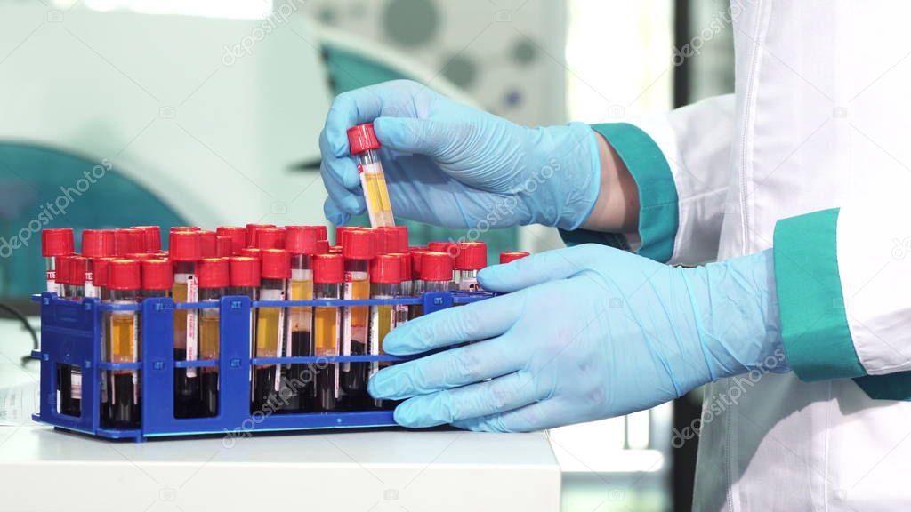 Cropped shot of a scientist in protectie gloves working with blood test tubes