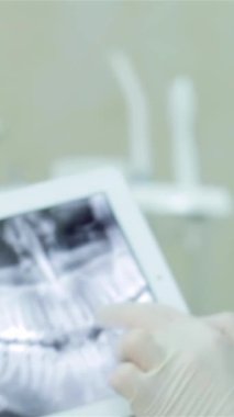 In a sleek, modern dental clinic, a dedicated dentist in crisp blue scrubs focuses intently on a detailed x-ray of a patients teeth displayed on a tablet. This captivating scene underscores the fusion of advanced technology and expert care