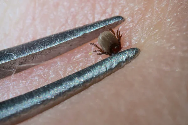 Super Close Sucking Tick Ixodes Ricinus Remoção Com Pinças Aço — Fotografia de Stock