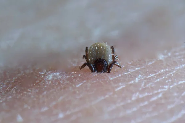 Szuper Közelről Szívja Ixodes Ricinus Emberi Bőrön Felnőttek Táplálkoznak Nagy — Stock Fotó