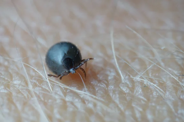 Super Close Macro Sânge Umplut Negru Culoare Gri Închis Căpușă — Fotografie, imagine de stoc