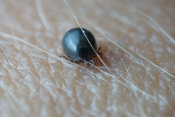 Super close up macro of blood filled black dark grey colored male tick (Ixodes ricinus) crawling over human skin.