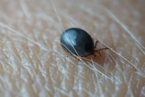 Super close up macro of blood filled black dark grey colored male tick (Ixodes ricinus) crawling over human skin.