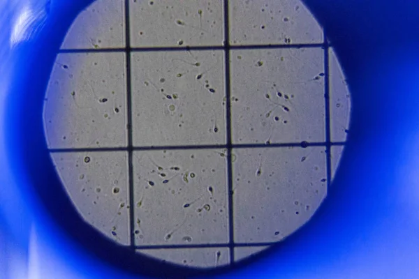 Detail Des High Tech Mikroskops Zur Untersuchung Von Spermien Zur — Stockfoto