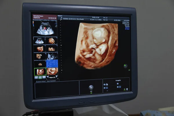 Monitor Baby Images Process Gestation Fertility Clinic — Stock Photo, Image