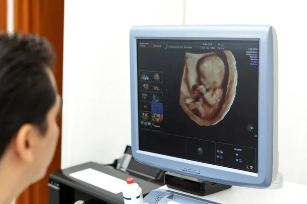 USG dziecka na monitorze — Zdjęcie stockowe