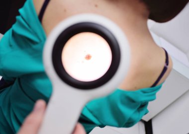 Doktor hastanın bir büyüteç ile doğum lekeleri inceliyor