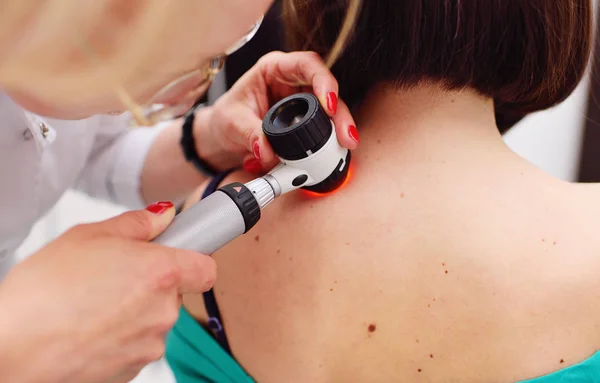 The dermatologist examines the moles or acne of the patient with a dermatoscope