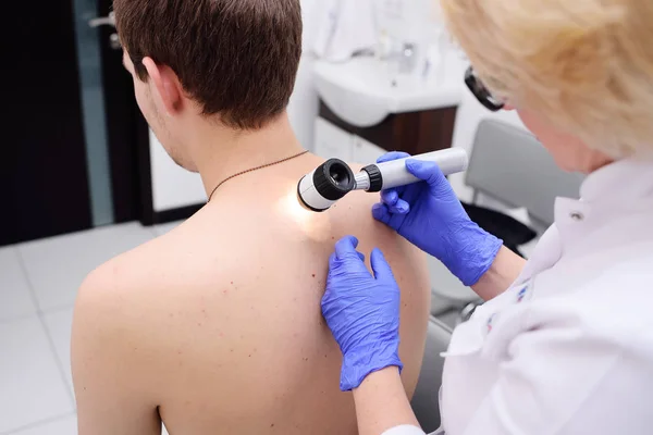 Lekarz dermatolog bada znamion i znamion pacjenta z dermatoscope — Zdjęcie stockowe