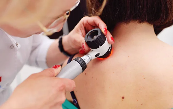 O dermatologista examina as toupeiras ou acne do paciente com um dermatoscópio — Fotografia de Stock