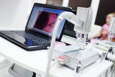 Bir laptop monitör bir Doğum lekesi veya siğiller yakın çekim görüntüsü.