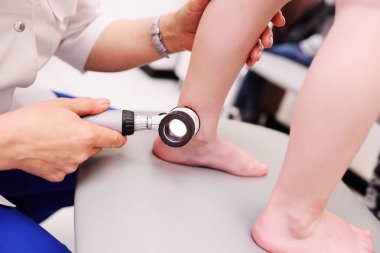 Melanom tanı. Doktor hasta köstebek inceliyor