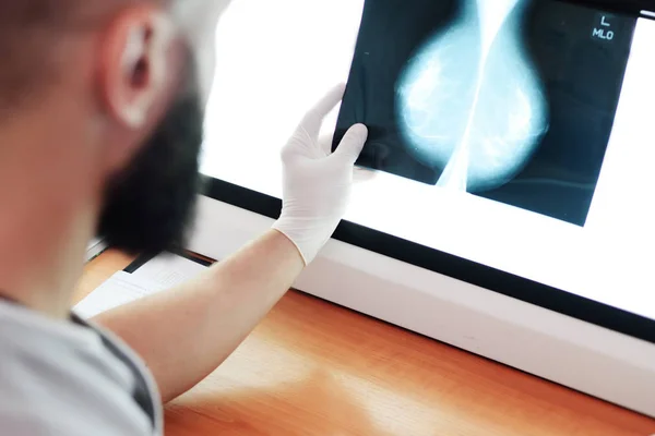 Médico Observa Una Imagen Mamografía Resultado Examen Rayos Las Glándulas —  Fotos de Stock