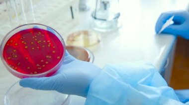 Koloni mikroplar ve bakteriyolojik bir laboratuvar Petri kabına patojenik mantar