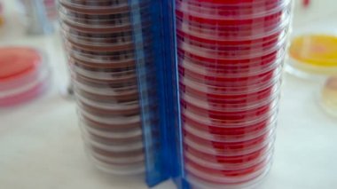 Koloni mikroplar ve bakteriyolojik bir laboratuvar Petri kabına patojenik mantar