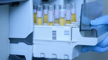 Bir bilim adamı bir laboratuvar test tüplerini kan veya idrar termal Gravimetre kapsayıcısında yerleştirir.