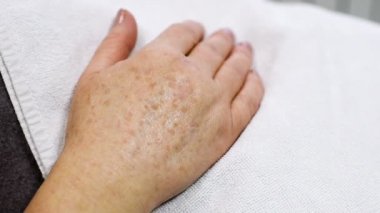 pigmentasyon yakın çekim yaşlı kadın elle