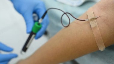 Doktor plasmolifting önce hastadan kan alır