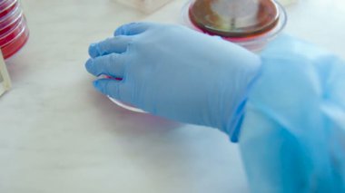 Koloni mikroplar ve bakteriyolojik bir laboratuvar Petri kabına patojenik mantar