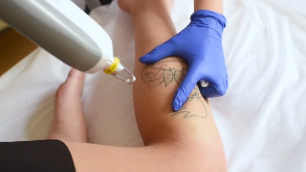 Το cosmetologist αφαιρεί το τατουάζ στο πόδι του μια όμορφη κοπέλα με ένα λέιζερ. — Αρχείο Βίντεο