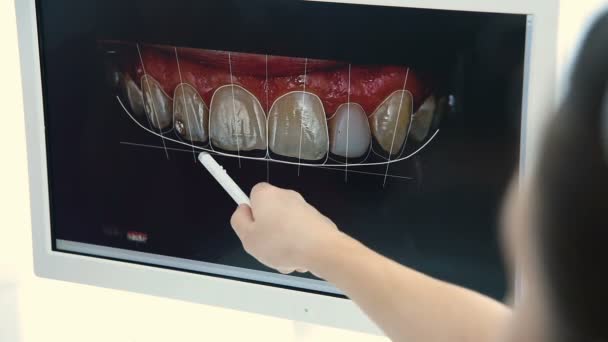 A fogorvos a fogak pillanatfelvételének megjelenítése a beteg — Stock videók