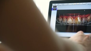 Diş hekimi hastaya dişlerini bir görüntüsünü gösterir.