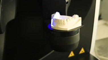 3-d takma diş alçı üzerinden tarama