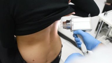 Doğum lekeleri ve moles.the doktor hasta köstebek inceliyor