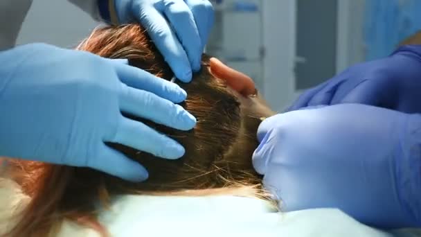 Arts cosmetoloog dermatoloog injecteert het plasma in de hoofdhuid van de patiënt. — Stockvideo