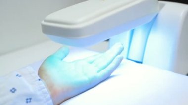 elleri olan bir hastanın bir ultraviyole lambası altında sedef yakın çekim.