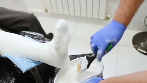 Traumatologe legt Pflaster auf gebrochenes Bein des Patienten. — Stockvideo
