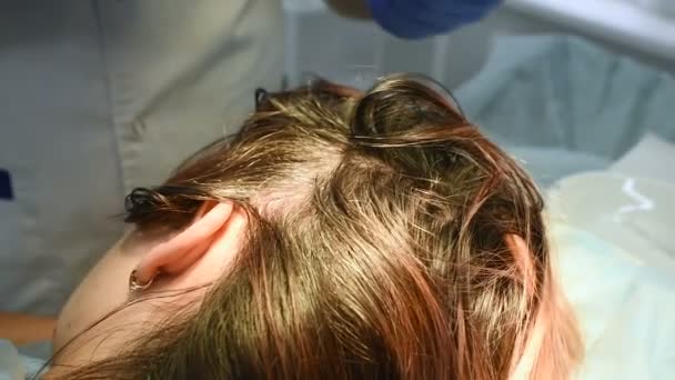 Orvos kozmetológus bőrgyógyász befecskendezi a plazmát a beteg fejbőrébe. — Stock videók