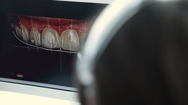 Zubař ukazuje pacient snímek zuby — Stock video