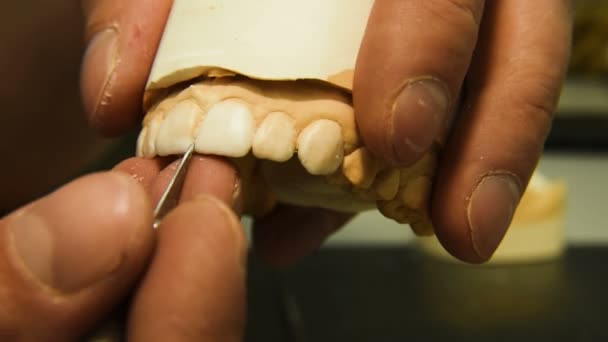 Dentysta sprawia, że implanty — Wideo stockowe