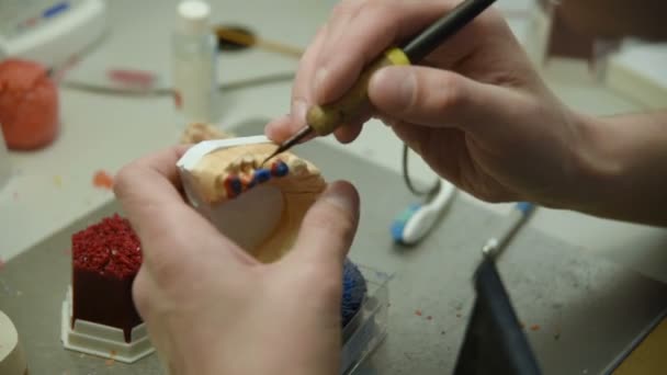 Стоматолог робить форму зубів — стокове відео