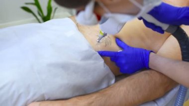 Dövme hasta adam profesyonel lazer güzellik uzmanı Doktor kaldırır.