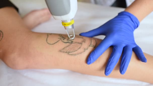 Cosmetologist Αφαιρεί Τατουάζ Στο Πόδι Του Μια Όμορφη Κοπέλα Ένα — Αρχείο Βίντεο