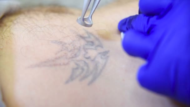 Schoonheidsspecialist arts verwijdert tattoo geduldige man professionele laser. — Stockvideo